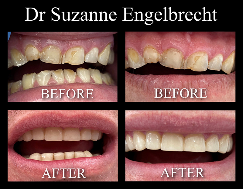Before & After nr.1