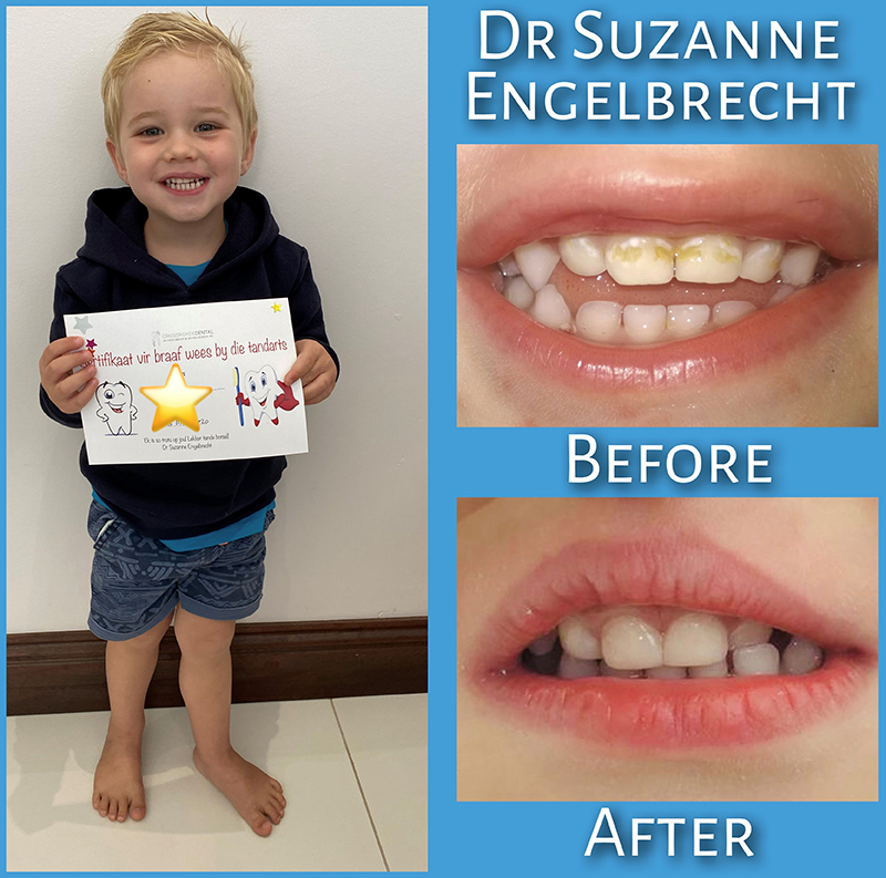 Before & After nr.3