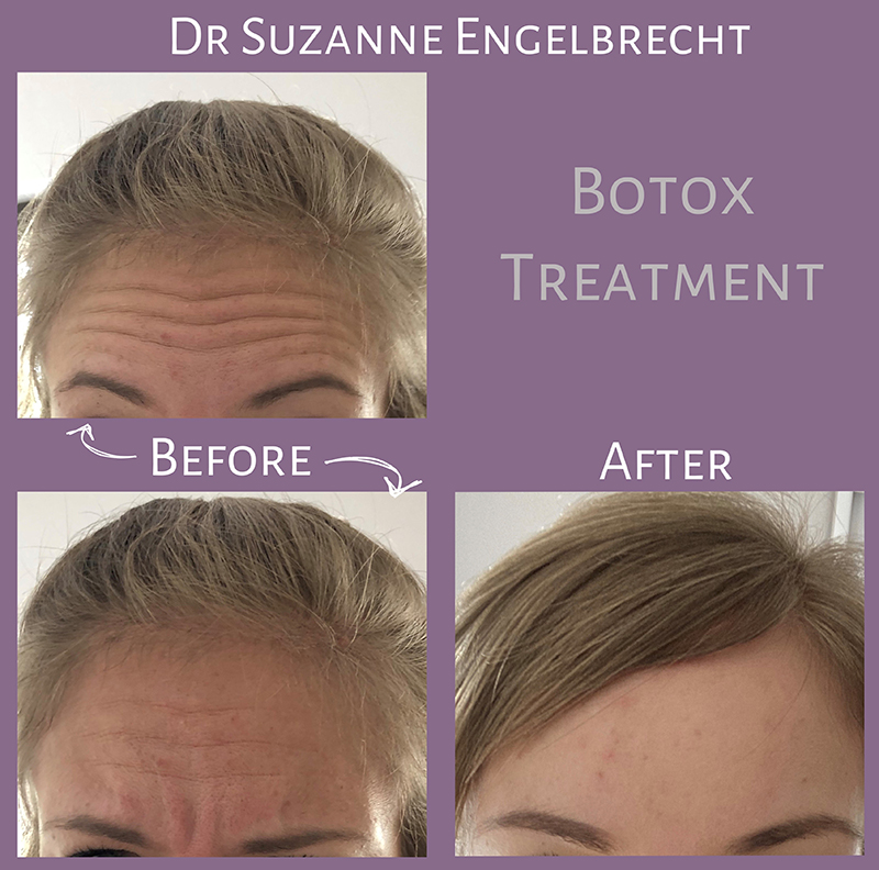 Before & After nr.5